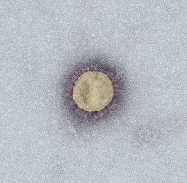 Bild eines Coronavirus (Nahaufnahme)